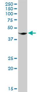 T Antibody in Western Blot (WB)