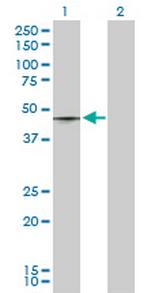 T Antibody in Western Blot (WB)