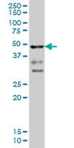 T Antibody in Western Blot (WB)