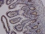 ADAM17 Antibody in Immunohistochemistry (Paraffin) (IHC (P))