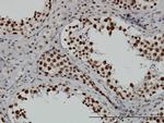 TAF11 Antibody in Immunohistochemistry (Paraffin) (IHC (P))