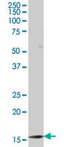 TAF12 Antibody in Western Blot (WB)