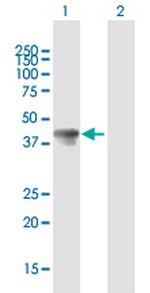 TAL1 Antibody in Western Blot (WB)