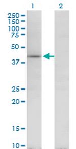 TARBP2 Antibody in Western Blot (WB)