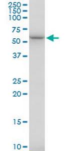 TBCE Antibody in Western Blot (WB)