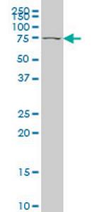 TBX2 Antibody in Western Blot (WB)