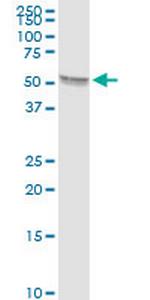 TBX5 Antibody in Western Blot (WB)