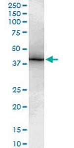 TBX6 Antibody in Western Blot (WB)