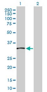 TCEA2 Antibody in Western Blot (WB)