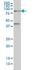 TCF4 Antibody in Western Blot (WB)