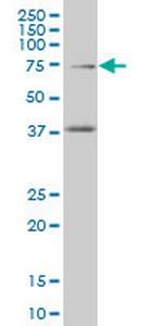 TCF4 Antibody in Western Blot (WB)