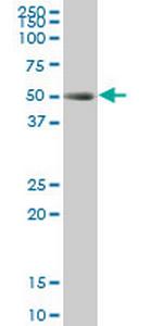 TCF2 Antibody in Western Blot (WB)