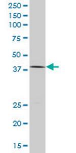 TCF2 Antibody in Western Blot (WB)