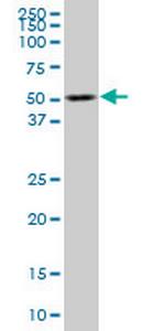 TCF2 Antibody in Western Blot (WB)