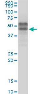 TCF7 Antibody in Western Blot (WB)