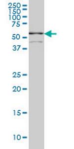 TCF7L2 Antibody in Western Blot (WB)