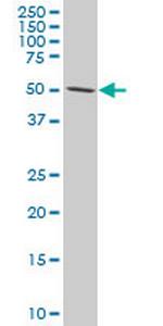 TCF7L2 Antibody in Western Blot (WB)