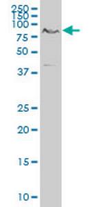 TCF7L2 Antibody in Western Blot (WB)