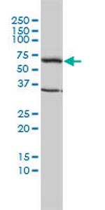 TCP1 Antibody in Western Blot (WB)