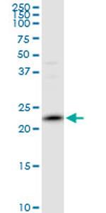 PRDX2 Antibody in Western Blot (WB)