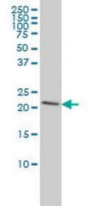 PRDX2 Antibody in Western Blot (WB)