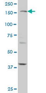 TEK Antibody in Western Blot (WB)