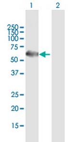 TERF1 Antibody in Western Blot (WB)