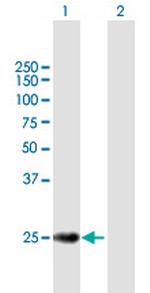 TERF2 Antibody in Western Blot (WB)