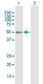 NR2F2 Antibody in Western Blot (WB)