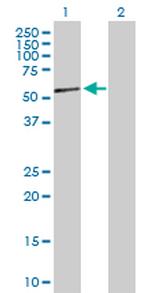 NR2F2 Antibody in Western Blot (WB)