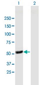 TFDP1 Antibody in Western Blot (WB)