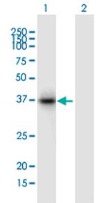 TFPI Antibody in Western Blot (WB)