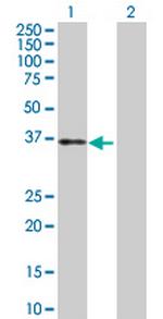 TFPI Antibody in Western Blot (WB)