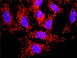 TGFB1 Antibody in Proximity Ligation Assay (PLA) (PLA)