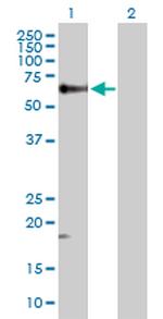 TGFB1 Antibody in Western Blot (WB)