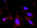 TGFB1 Antibody in Proximity Ligation Assay (PLA) (PLA)