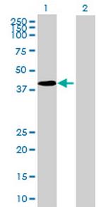 TGFB1I1 Antibody in Western Blot (WB)