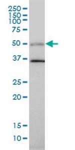 TGFB1I1 Antibody in Western Blot (WB)