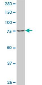 TGM2 Antibody in Western Blot (WB)