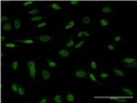 NKX2-1 Antibody in Immunocytochemistry (ICC/IF)