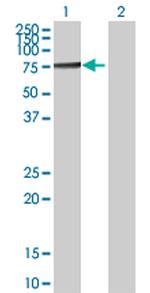 TKT Antibody in Western Blot (WB)