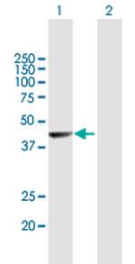 NR2E1 Antibody in Western Blot (WB)