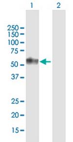 TNFRSF1A Antibody in Western Blot (WB)