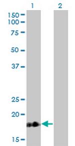 TNNC1 Antibody in Western Blot (WB)