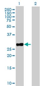 TNNI3 Antibody in Western Blot (WB)