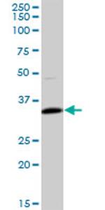 TNNT1 Antibody in Western Blot (WB)