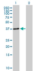 TNNT1 Antibody in Western Blot (WB)