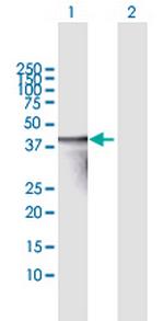 TNNT3 Antibody in Western Blot (WB)