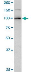 TOP1 Antibody in Western Blot (WB)