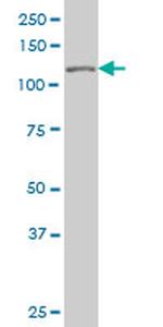 TP53BP2 Antibody in Western Blot (WB)